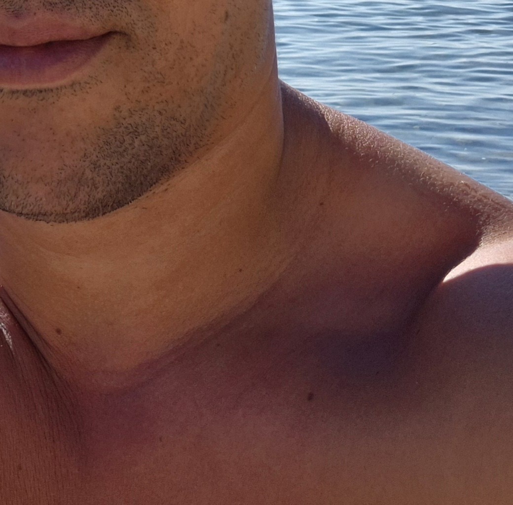 Barnabé - Gipf-Oberfrick - Argovie | Strip Tease