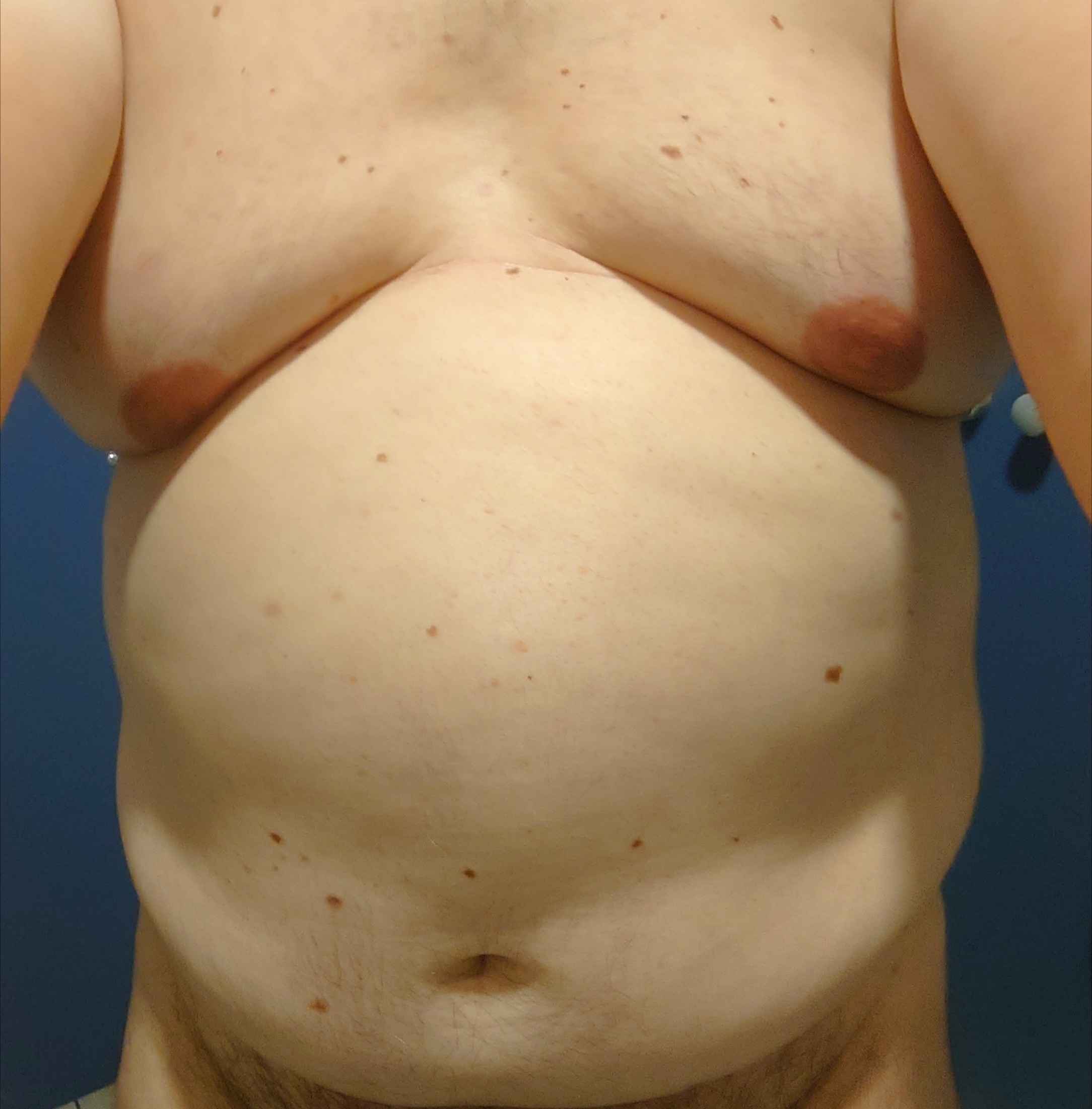 Anthonio - Ghirone - Tessin | Strip Tease