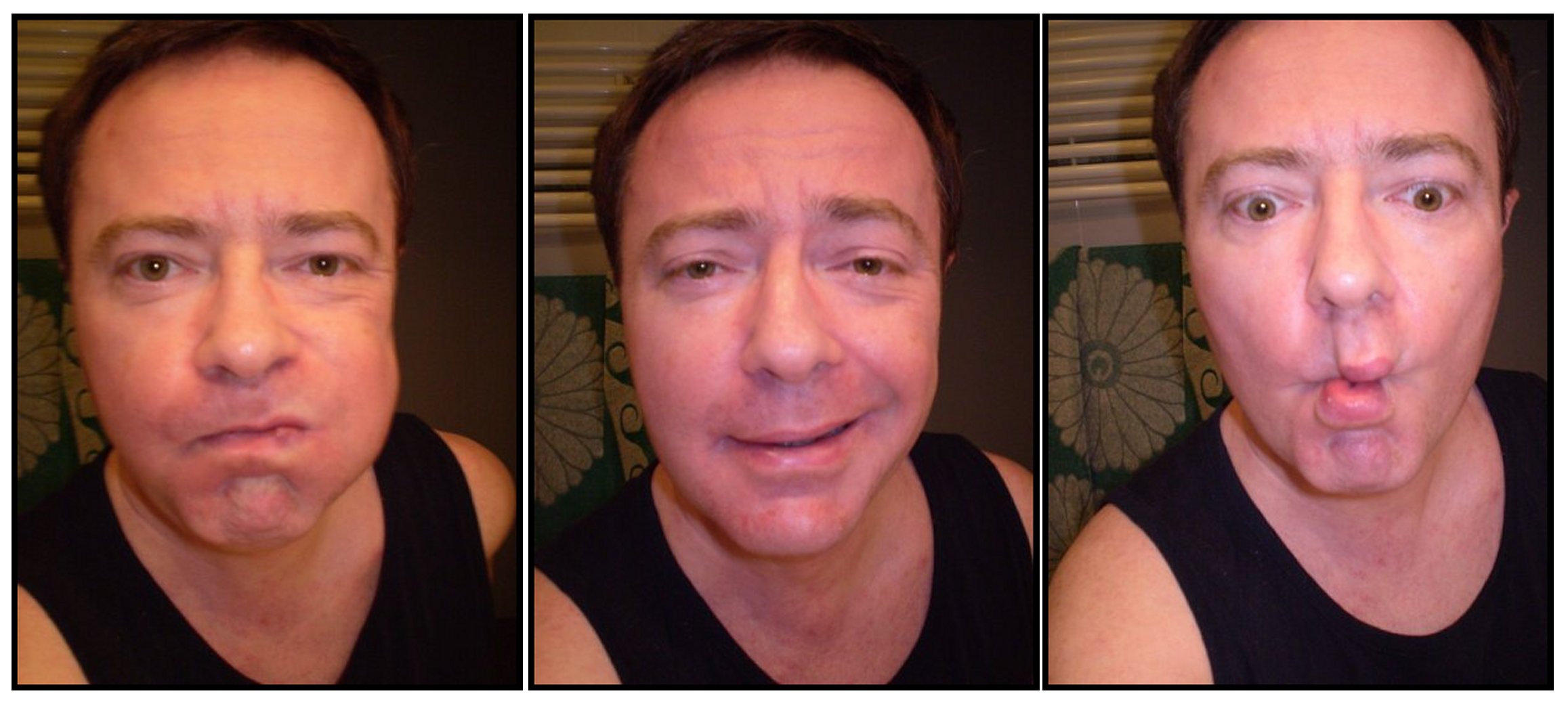 Neder - Medels im Rheinwald - Grisons | Strip Tease