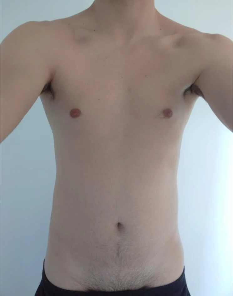 Jean-martin - Rongellen - Grisons | Strip Tease