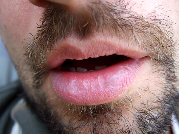 Hamon - Filzbach - Glaris | Strip Tease